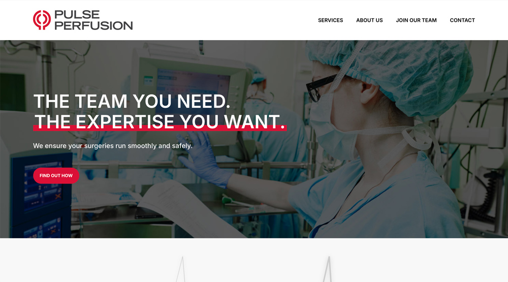 Pulse Perfusion